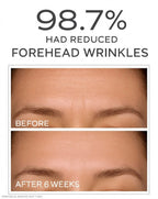 ROUMATICS Advanced Correcting Serum
